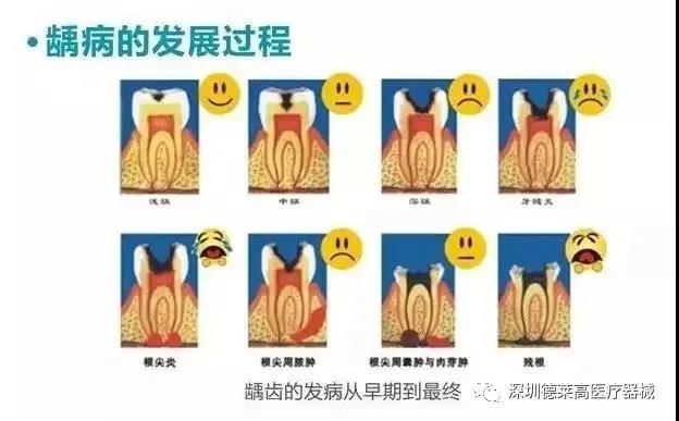 龋病的发展过程